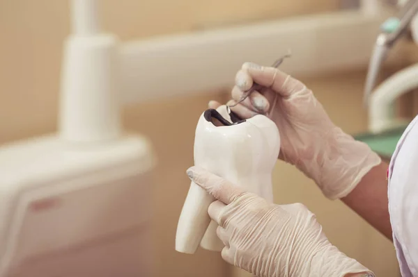 O retrato de uma dentista mostra uma amostra de dentes com cárie ao seu paciente no consultório. Dental care Concept. Inspecção dentária está a ser dada a um homem bonito rodeado de dentista e seu assistente — Fotografia de Stock
