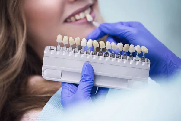 Schönes Europäisches Frauenlächeln Mit Gesunder Zahnaufhellung Zahnpflegekonzept Set Von Implantaten — Stockfoto