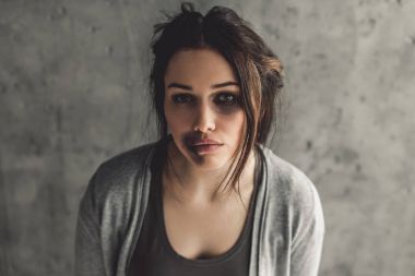 Kız çarptı varlık 