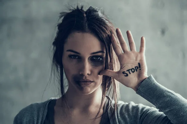 Oppressed woman shows by hand sign stop. Bruises on face. — Stock Photo, Image