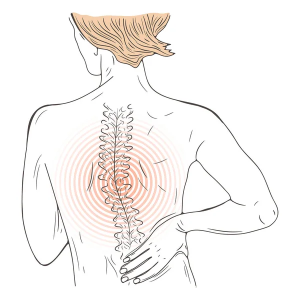 Векторная Иллюстрация Человеком Страдающим Боли Спине — стоковый вектор