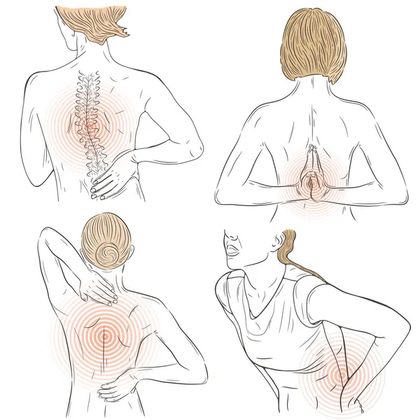 Векторный Набор Иллюстрациями Людей Страдающих Болей Спине Переживаю Раненый Рисунок — стоковый вектор