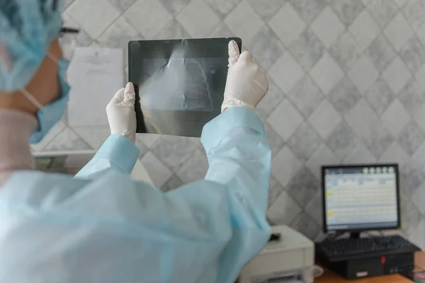 Bir doktor koronavirüs hastalığı olan bir hastanın florografi taramasına bakıyor..