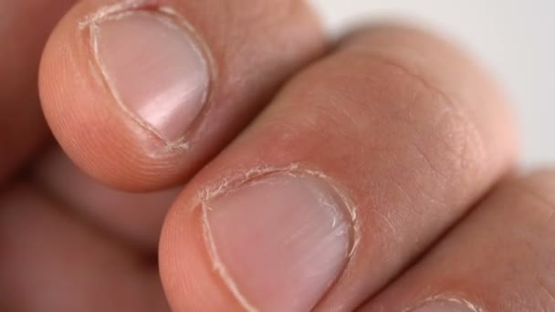 Uñas en los dedos de un hombre — Vídeos de Stock