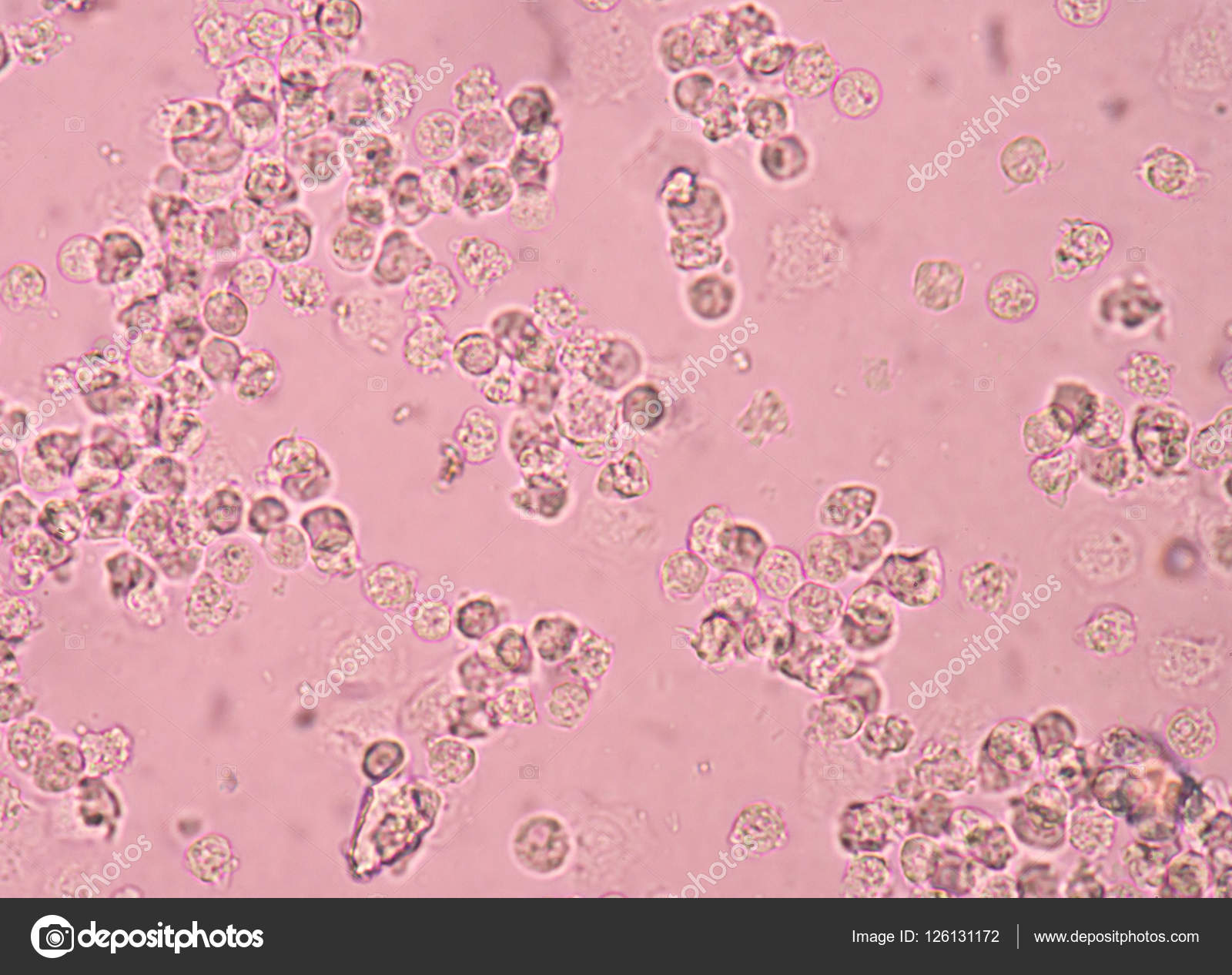 Witte Bloedcellen In De Urine ⬇ Stockfoto, Rechtenvrije Foto Door ©  Toeytoey #126131172