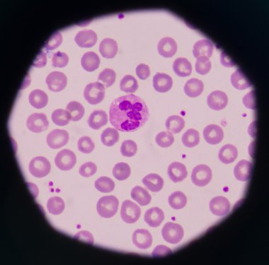 beyaz kan hücreleri