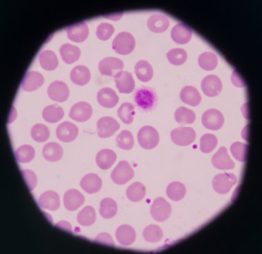 beyaz kan hücreleri