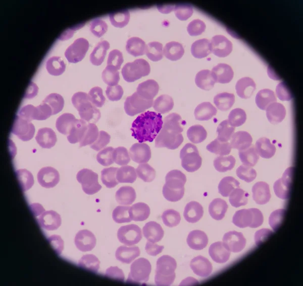 Белые клетки крови — стоковое фото