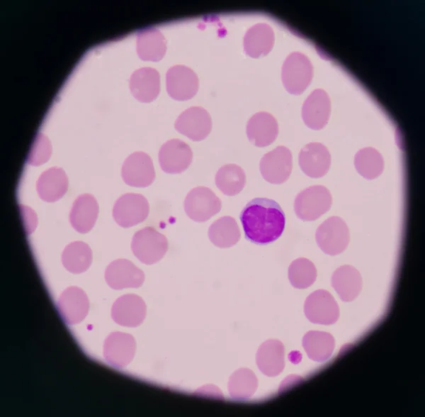 Білих клітин крові — стокове фото