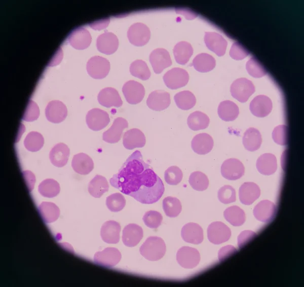 Білих клітин крові — стокове фото