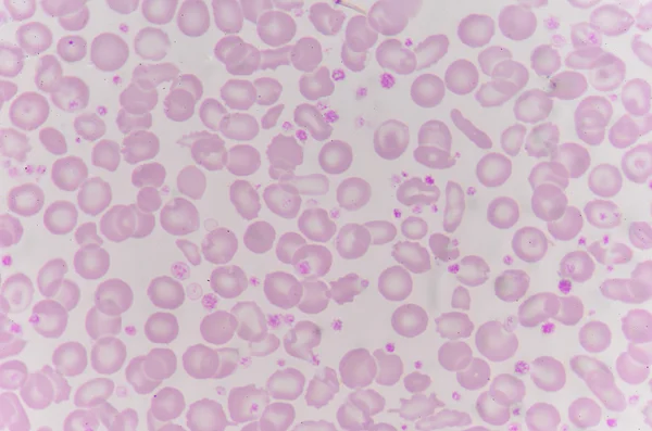 Red blood cells with white blood cells background. — Stock Photo, Image