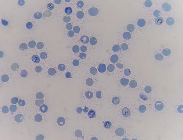 적혈구 reticulocyte — 스톡 사진