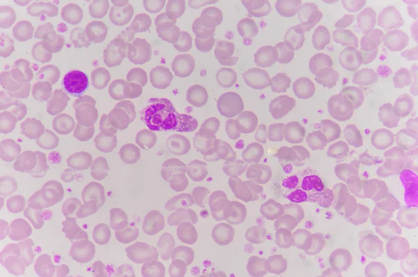Globuli rossi con sfondo di globuli bianchi . — Foto Stock