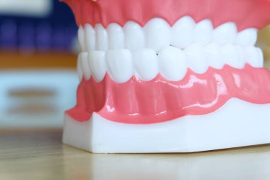 Model diş beyazlatma. Diş Bakımı.