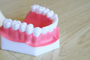 Model diş beyazlatma. Diş Bakımı.