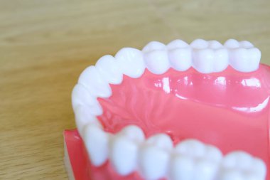 Model diş beyazlatma. Diş Bakımı.