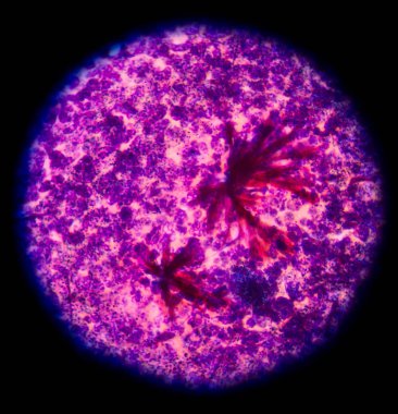 kırmızı kan hücreleri tıbbi geçmişi kavramı içinde mikroskop altında.