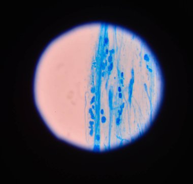 Maya hücreleri pseudohyphae idrar gram St ile filizlenen dallanma