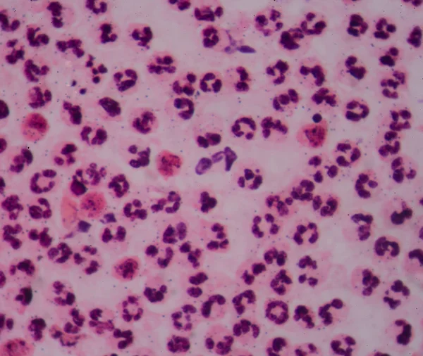 Witte bloedcellen gematigde — Stockfoto
