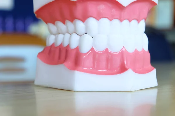 Model teeth whitening. Dental care. — Stock Photo, Image
