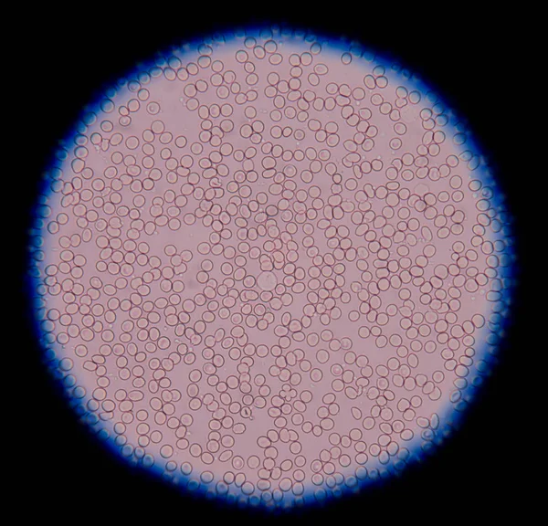 Glóbulos vermelhos ao microscópio no conceito de antecedentes médicos . — Fotografia de Stock
