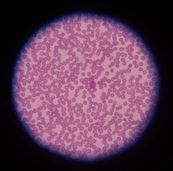 红血细胞显微镜在医学背景概念下. — 图库照片