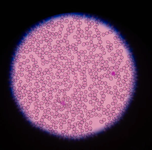 Globuli rossi al microscopio nel concetto di sfondo medico . — Foto Stock