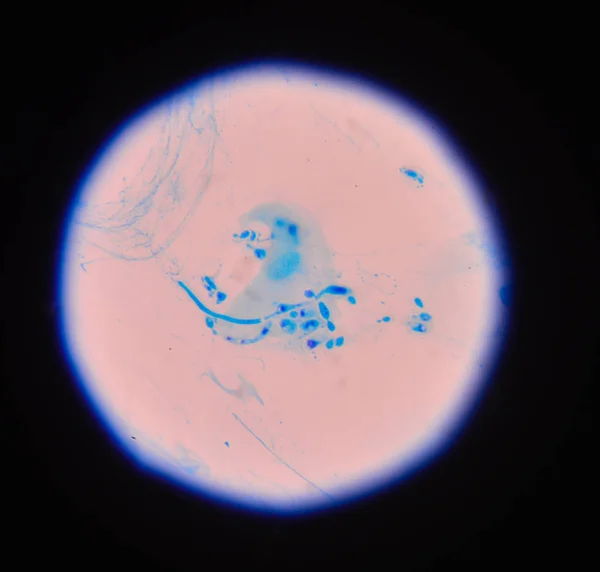 Vertakking ontluikende gistcellen met pseudohyphae in urine gram st — Stockfoto