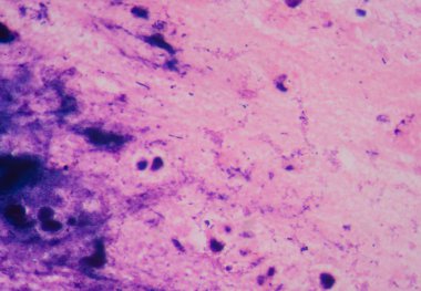 Gram boyama, Gram'ın yöntemi olarak da adlandırılan bir yöntemdir