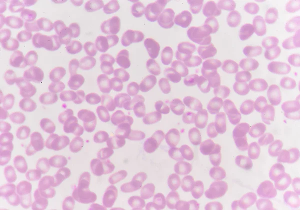 Red blood cells with white blood cells background. — Stock Photo, Image