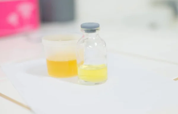 Análisis de orina en laboratorio en tono blanco . —  Fotos de Stock