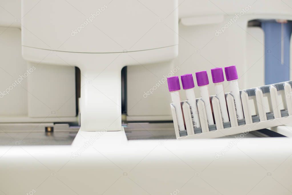 CBC Blood test tube in laboratory.