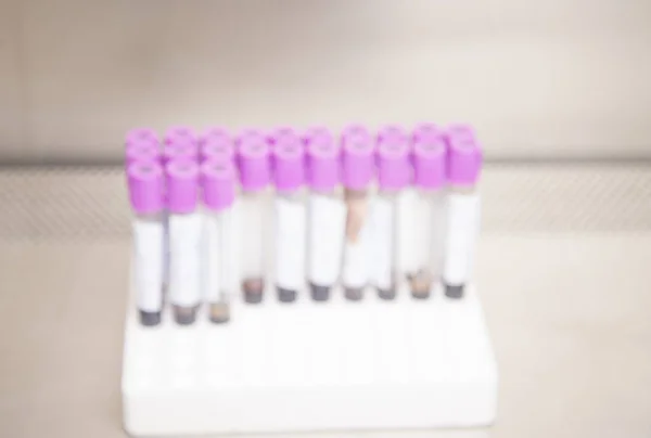 Blood test tube in laboratory.