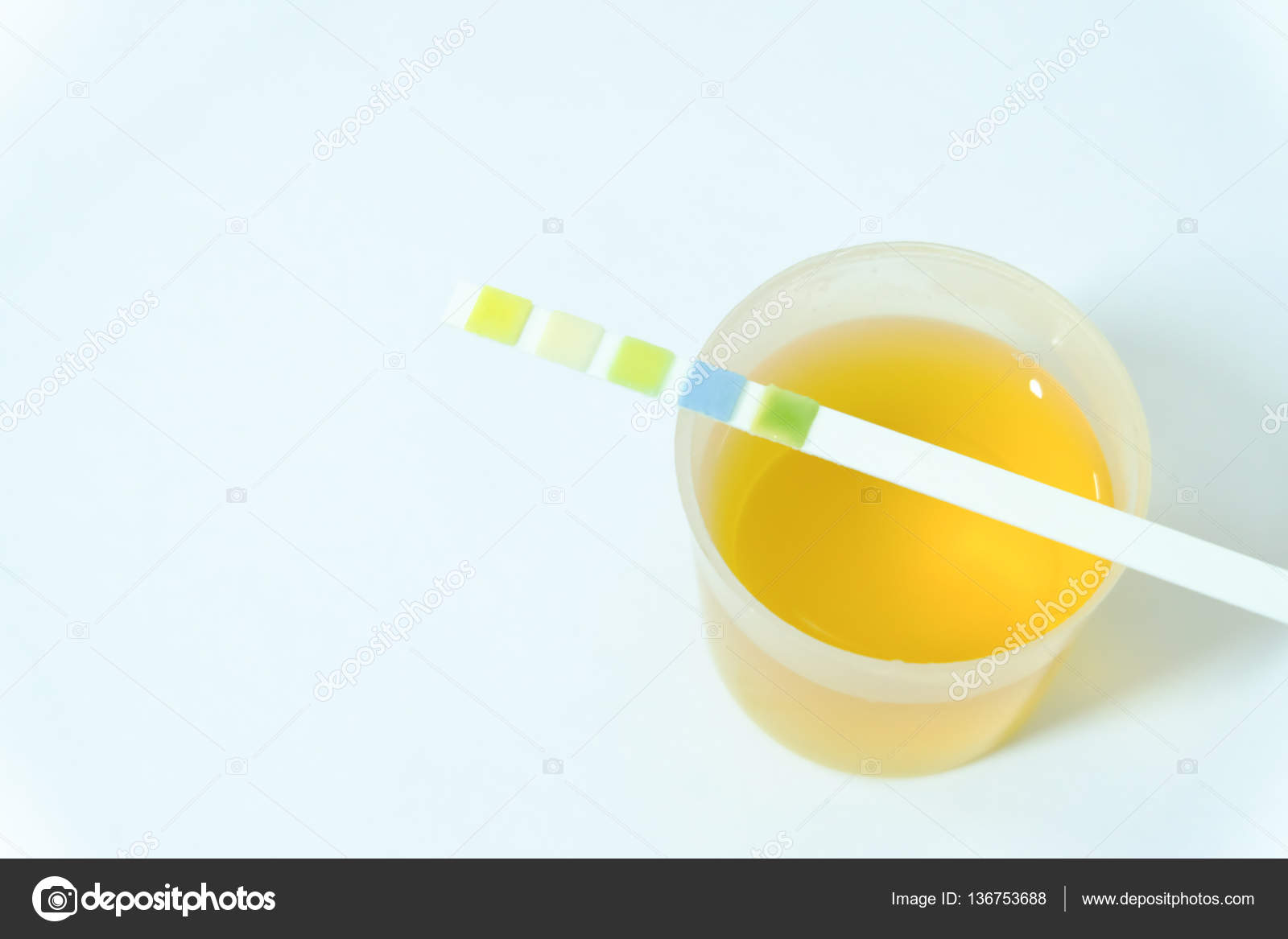Urine sample for laboratory analysis Stock Photo by ©toeytoey 136753688