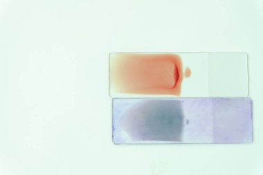 Kan yayması için Hematoloji 