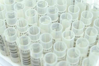 Tıbbi Laboratuar testleri 