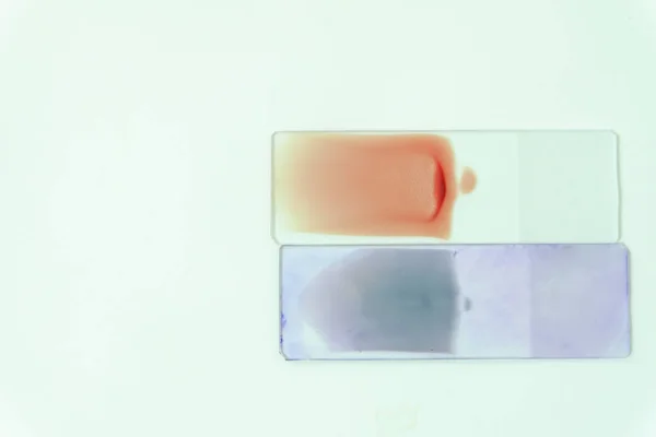 Blood smear for hematology — Stock Photo, Image