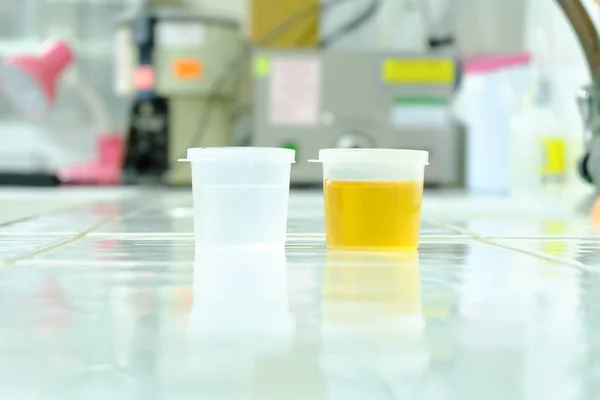 Urine sample for laboratory analysis — Stock Image Urine sample for laboratory analysis Stock Photo