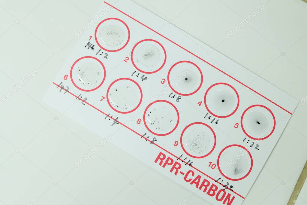 Prueba de RPR diaco reactivo para sífilis en laboratorio. 2023