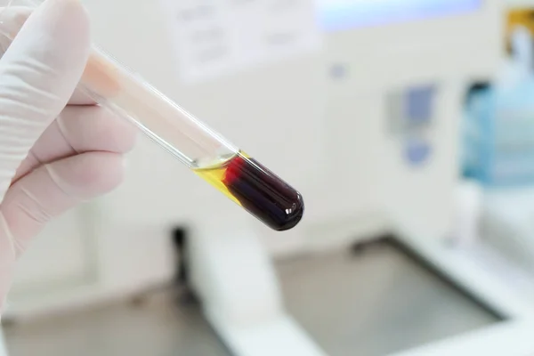Pıhtılaşmış kan serumu tes tüp laboratuvar arka planda ile. — Stok fotoğraf