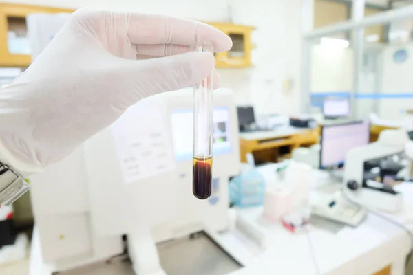 Sangue coagulato con siero in tes fondo laboratorio tubo . — Foto Stock