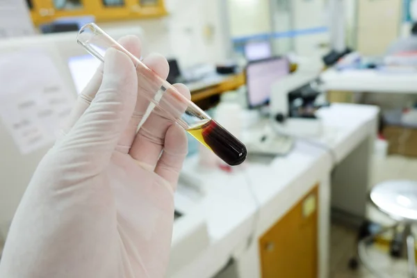 Sangue coagulado com soro no fundo do laboratório do tubo tes . — Fotografia de Stock