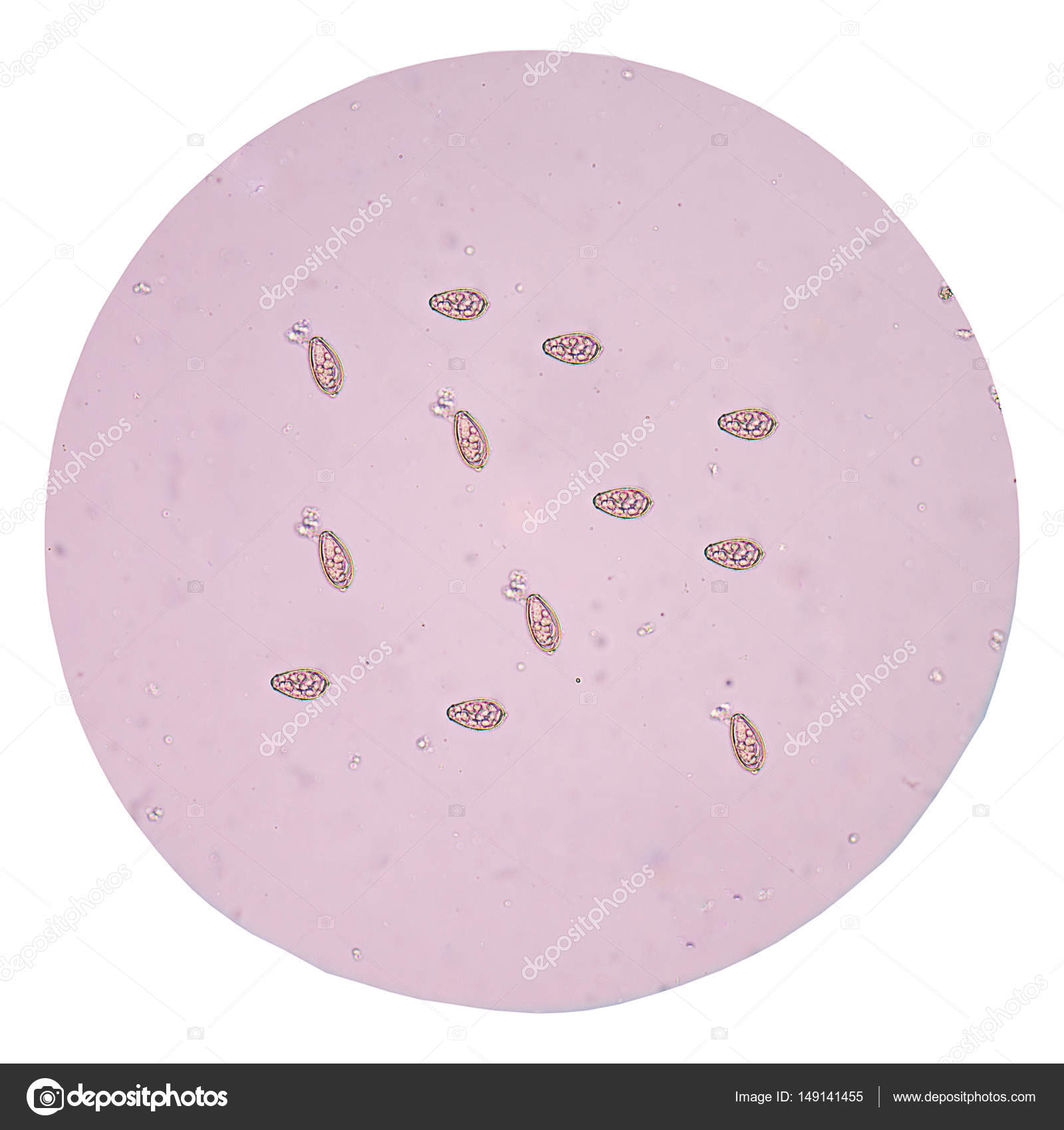 parasite eggs in stool