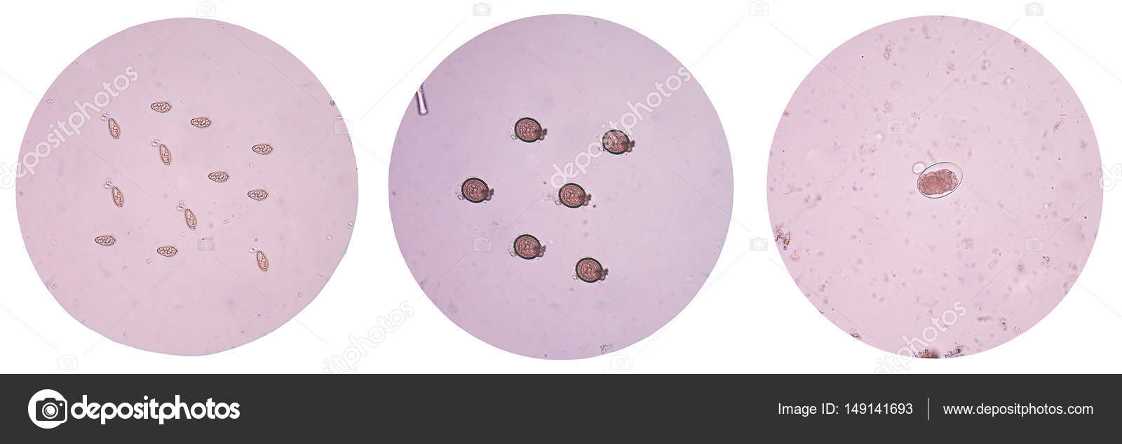 Amoebiasis, Entamoeba Histolytica, Life Cycle, Diagnosis, 59 OFF