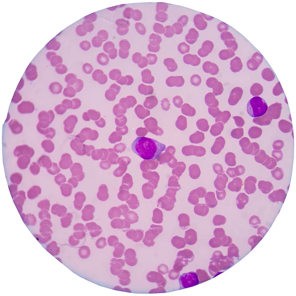 Glóbulos rojos y glóbulos blancos en los blancos — Foto de Stock