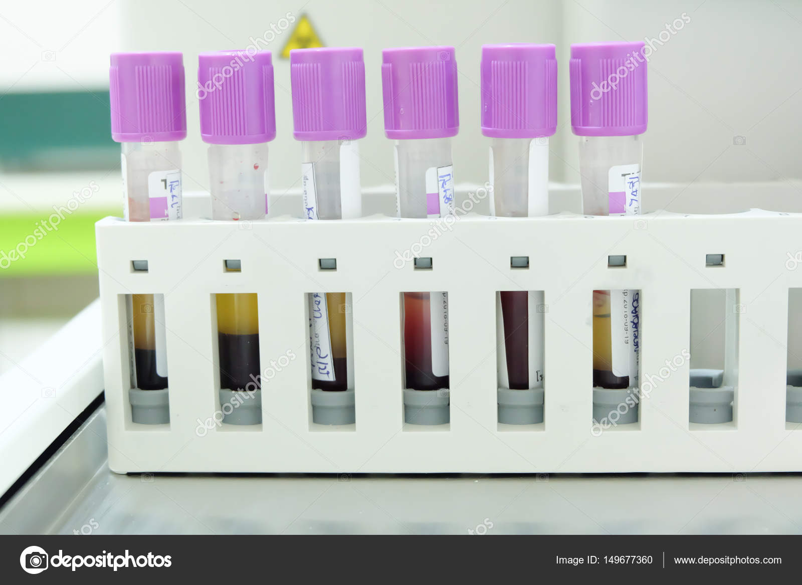 Test tube cbc lab — Stock Photo © toeytoey 149677360