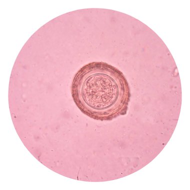 beyaz üzerine yumurta parazit