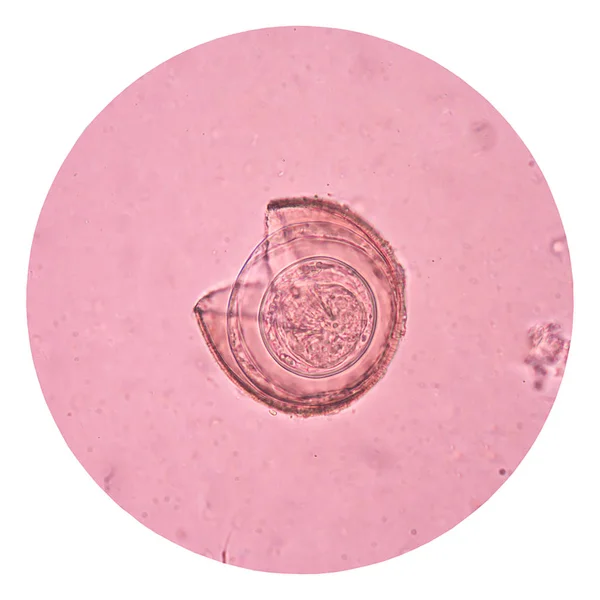 白卵寄生虫 — ストック写真