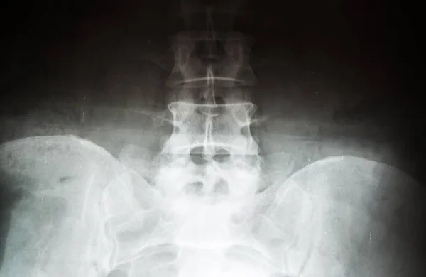 A medence röntgenképe — Stock Fotó