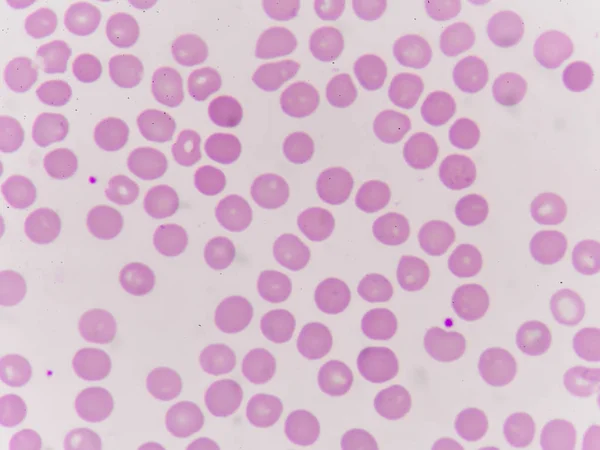 Normochromic normacytic red blood cells — Stock Photo, Image